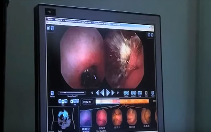 video_bowel-clinic